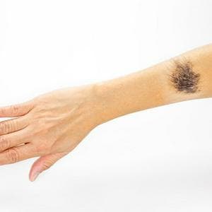 Show Their Scar Proudly MBTI Personality Type image